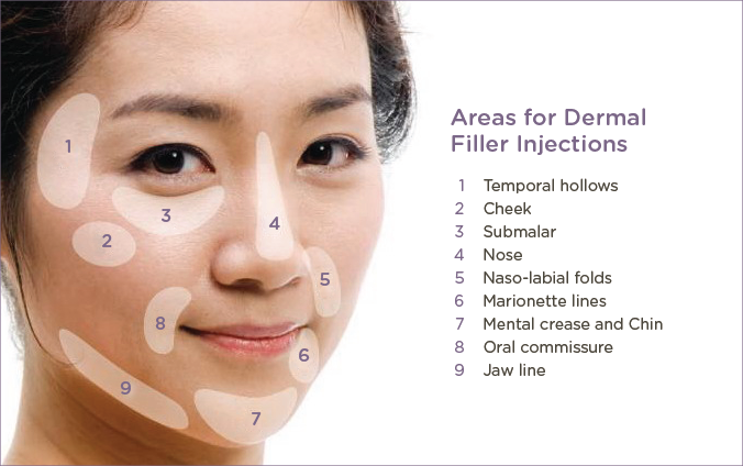 dermal fillers