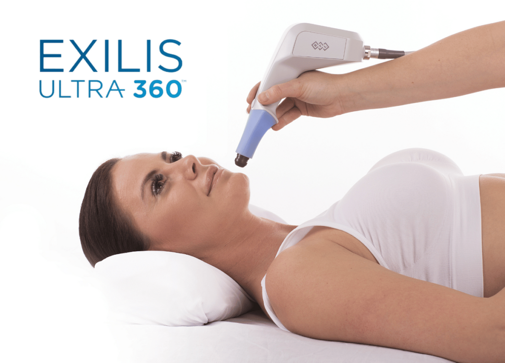 Exilis utra 360 treatment